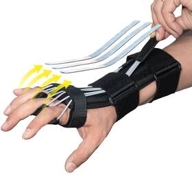 Pm009 Pucka Radial Nerve Palsy Splint Adjustable Dynamic Drop Wrist And Finger Spli Pm009 Pucka Radial Nerve Palsy Splint Adjustable Dynamic Drop Wrist And Finger Spli
